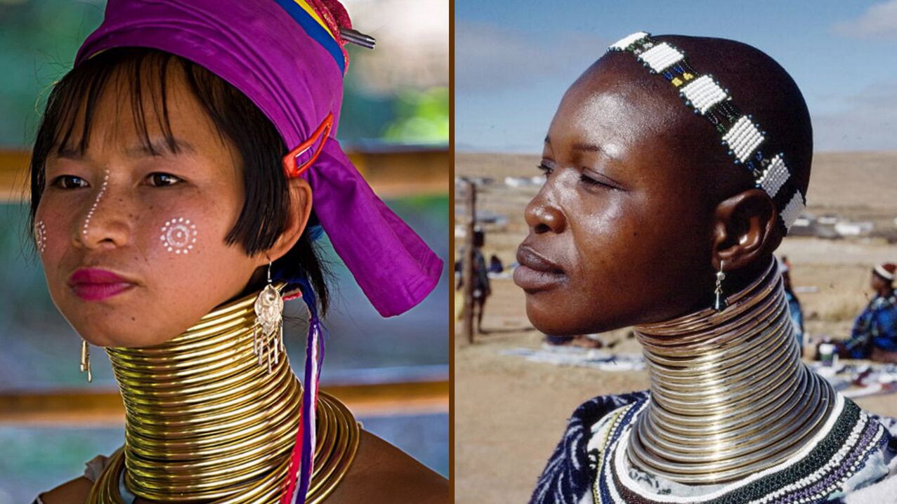 neck lengthening in women of the African race