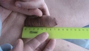 penis size measurement